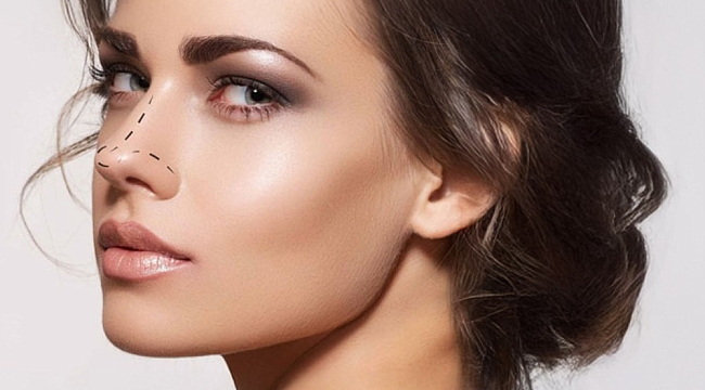 Kayseri estetik klinik